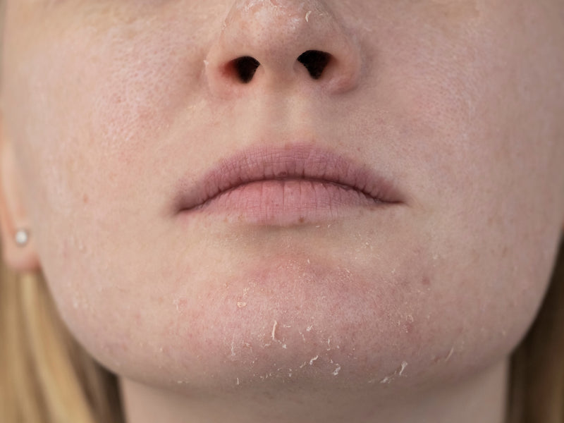 Dry & Sensitive Skin
