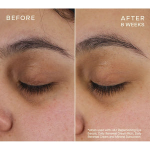Advanced Regenerative Eye Serum