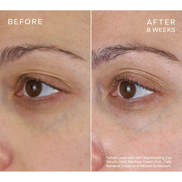 Advanced Regenerative Eye Serum