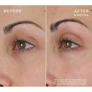 Advanced Regenerative Eye Serum