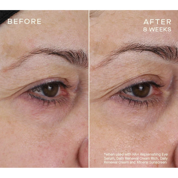 Advanced Regenerative Eye Serum
