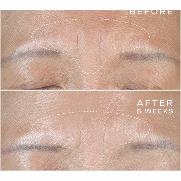 Advanced Regenerative Serum