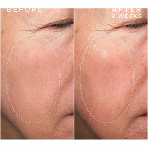 Advanced Regenerative Serum