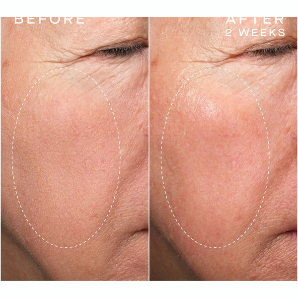 Advanced Regenerative Serum