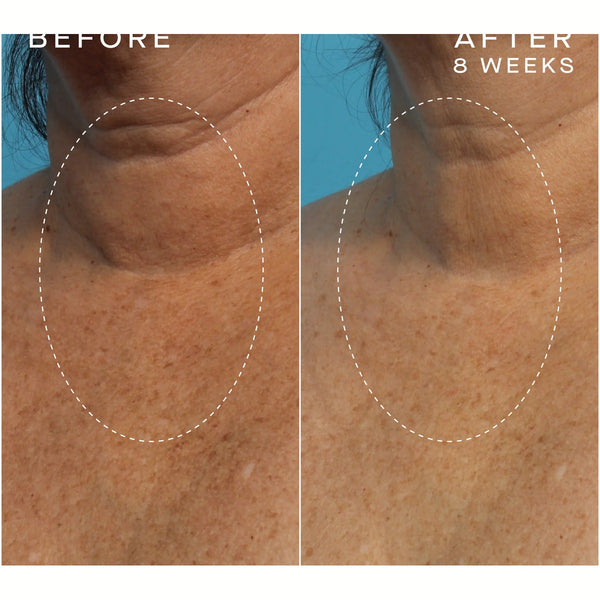 Advanced Regenerative Serum