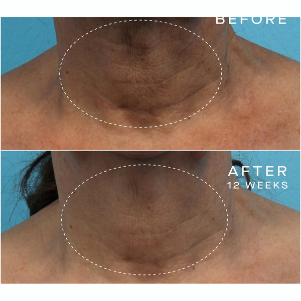 Advanced Regenerative Serum