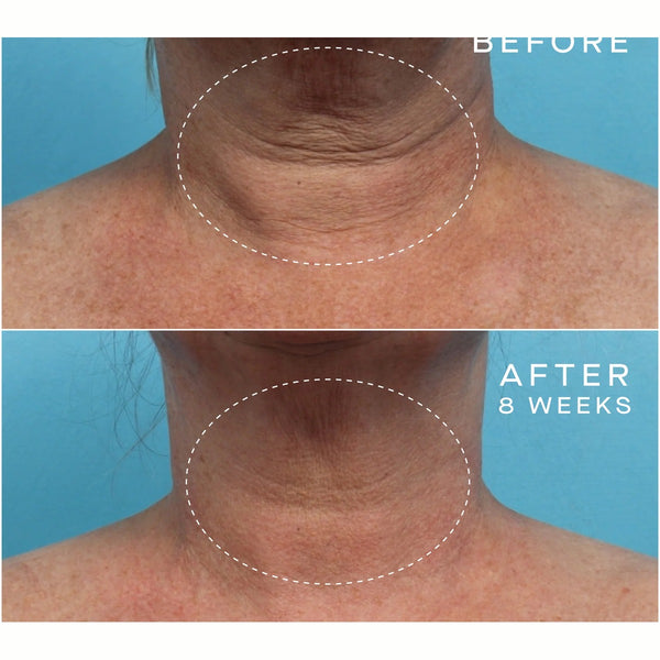 Advanced Regenerative Serum