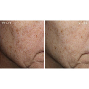 Complexion Brightening Serum