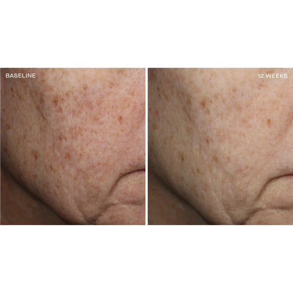 Complexion Brightening Serum