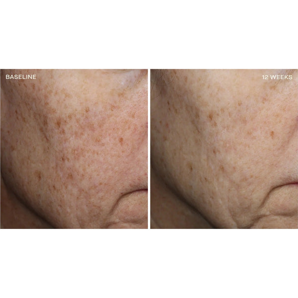 Complexion Brightening Serum