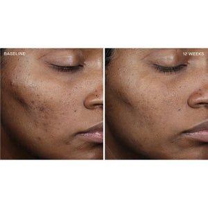 Complexion Brightening Serum
