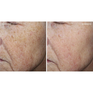 Complexion Brightening Serum