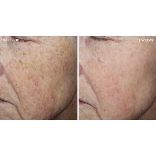 Complexion Brightening Serum