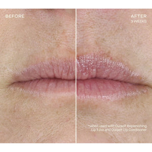Replenishing Lip Filler