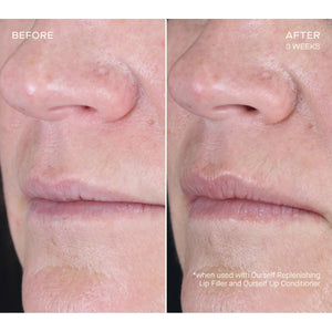 Replenishing Lip Filler