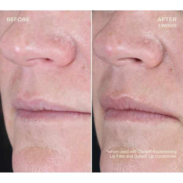 Replenishing Lip Filler